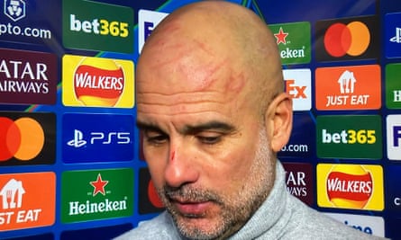 Pep Guardiola with scratch marks on his scalp and nose