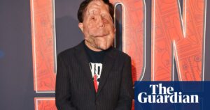 A Different Man’s Adam Pearson to star in new film of The Elephant Man