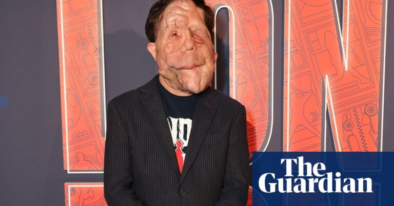 A Different Man’s Adam Pearson to star in new film of The Elephant Man
