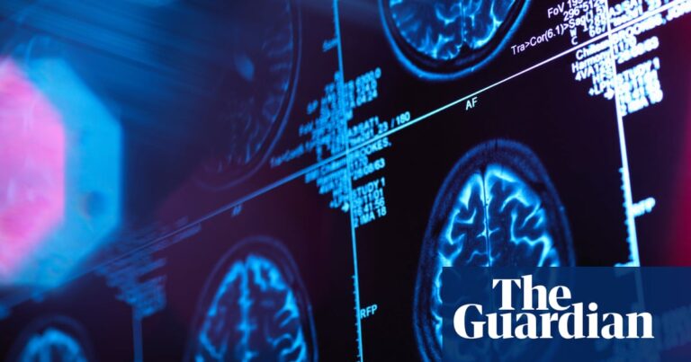 Canada medical mystery takes twist as study finds no evidence of brain illness